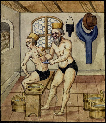 Aderlating met kopglazen door barbier in een badhuis. W. Geigenfeindt, 1613. Nrnberg, Stadtbibliothek.